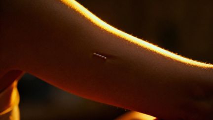 Implant antykoncepcyjny — jak wygląda i jak działa?