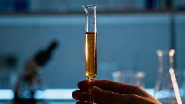 Zaburzenia hormonalne — przyczyny, objawy i metody leczenia